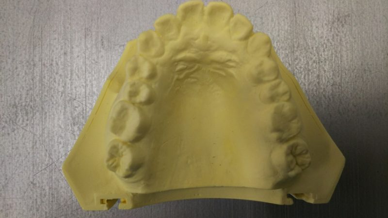 正常な歯列